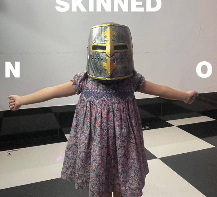 Skinned – NO